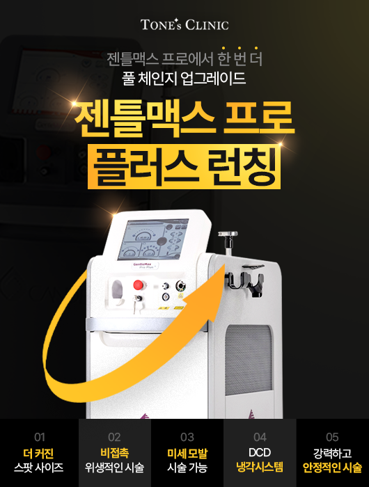 팝업
